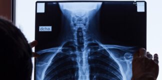 Auxiliar de serviços gerais com doença degenerativa tem indenização aumentada