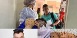 Cantor paraense Guto Xibatada morre em decorrência de complicações da Mpox