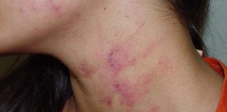 Adolescente é agarrada pelo pescoço e agredida por ex-namorado de 17 anos em Santo Anastácio