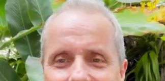 Tony Bellotto passa por cirurgia para retirada de tumor no pâncreas