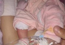 Bebê que teve o pé queimado ao fazer teste do pezinho continua internada em Prudente