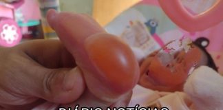 Bebê sofre queimaduras ao fazer o “Teste do Pezinho” em Panorama