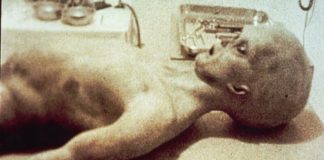 Suposta “autópsia” alienígena chocou o mundo na década de 1990