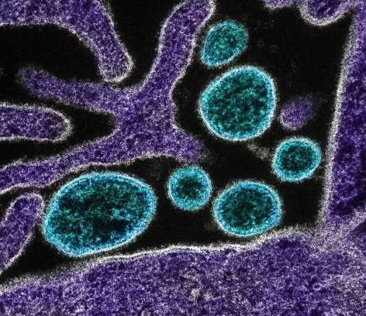 Nipah: Entenda como funciona o vírus com alto índice de mortalidade