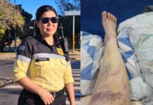 Conhecida agente de trânsito da Semob, Denise dos Santos, busca ajuda para tratamento após sofrer acidente